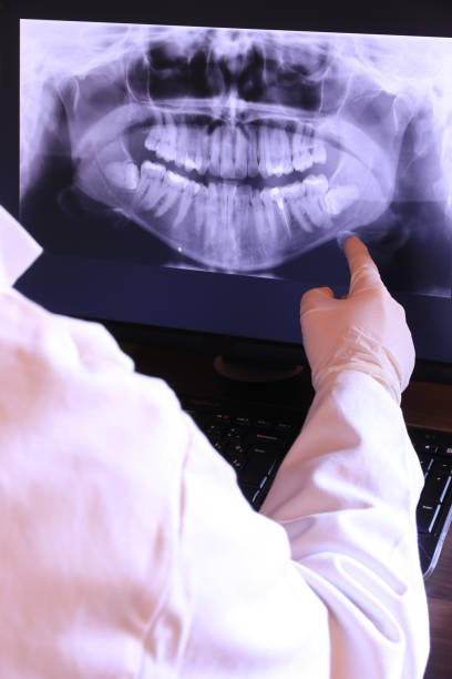 Best Emergency Wisdom Teeth Removal in Embreeville, TN